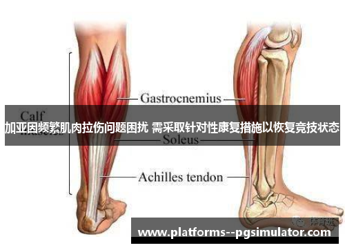 加亚因频繁肌肉拉伤问题困扰 需采取针对性康复措施以恢复竞技状态